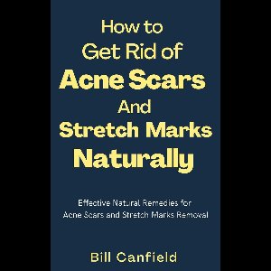 How to Get Rid of Acne Scars and Stretch Marks Naturally