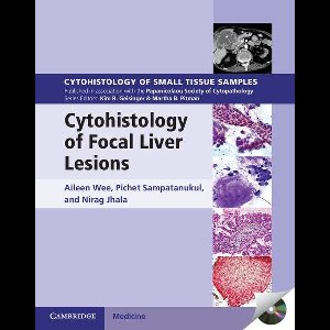 Cytohistology of Small Tissue Samples - Cytohistology of Focal Liver Lesions