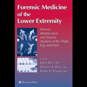 Forensic Medicine of the Lower Extremity