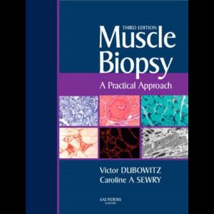 Muscle Biopsy: A Practical Approach