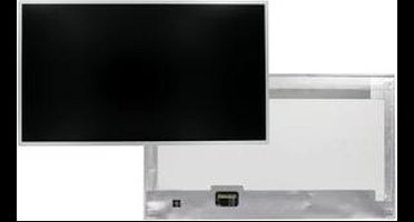 15.6 inch LCD scherm 1920x1080 mat 40Pin
