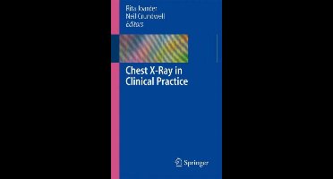 Chest X Ray in Clinical Practice