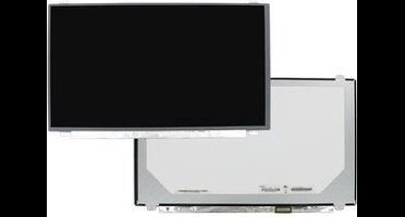 15.6 Inch LCD Scherm 1920x1080 Glans 30Pin eDP