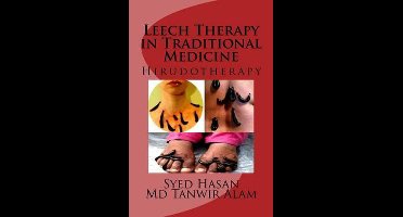Leech Therapy in Traditional Medicine