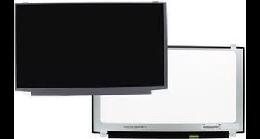 15.6 inch LCD scherm 1366x768 Glans 30Pin eDP