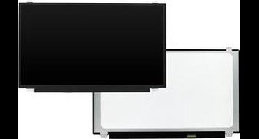 15.6 inch LCD Scherm 1366x768 Mat 30Pin eDP