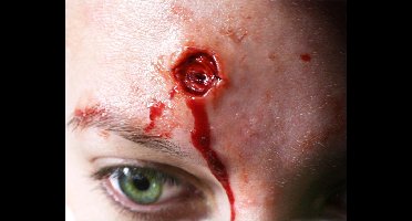 "Brand wonden op de huid - Schmink - One size"