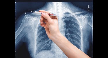 Edding 8010 Röntgenmarker Wit