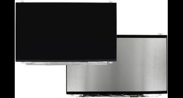 15.6 inch LCD Scherm 1920x1080 Glans 30Pin eDP, IPS