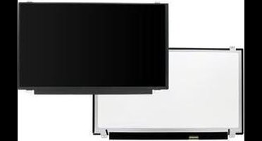 15.6 Inch LCD Scherm 1366x768 Glans 30Pin eDP