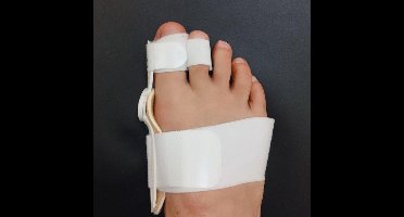 New Age Devi 1 stks Grote Bot Teen Bunion Spalk Stijltang Corrector Voetverzorging Pijnbestrijding Hallux Valgus Orthopedische Benodigdheden Pedicure Tool