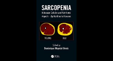 Sarcopenia