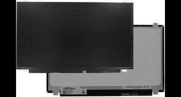 15.6 Inch LCD Scherm 1920x1080 Mat 30Pin eDP