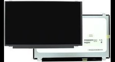 15.6 inch LCD scherm 1366x768 Mat 30Pin eDP