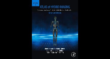 Atlas of Hybrid Imaging Sectional Anatomy for PET/CT, PET/MRI and SPECT/CT Vol. 1: Brain and Neck