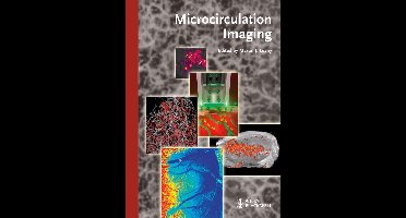 Microcirculation Imaging
