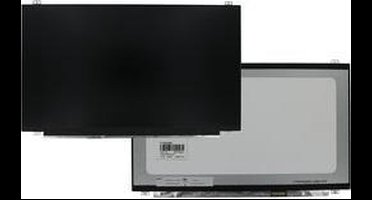 15.6 Inch LCD Scherm 1920x1080 Mat 30Pin eDP