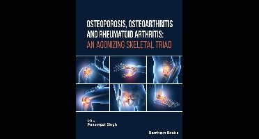 Osteoporosis, Osteoarthritis and Rheumatoid Arthritis: An Agonizing Skeletal Triad