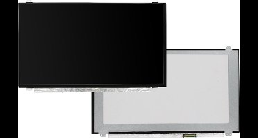 15.6 inch LCD Scherm 1920x1080 Mat 40Pin eDP, IPS, 144Hz