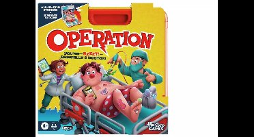 Hasbro Operation spel - Elektronisch bordspel voor kinderen (Engelstalig).