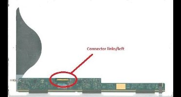 15.6 inch LCD Scherm 1366x768 Glans 40Pin