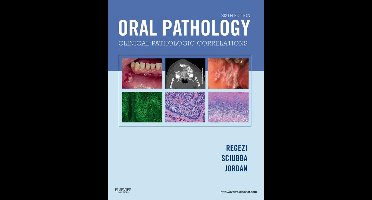 Oral Pathology - E-Book