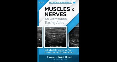 TECHNICAL ULTRASOUND HANDBOOK - MUSCLES & NERVES: An Ultrasound Tracing Atlas series 1 - TECHNICAL ULTRASOUND HANDBOOK - MUSCLES & NERVES