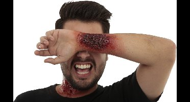 Partychimp Applicatie Armwond Arm Latex Rood/zwart