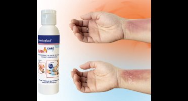 Detectaplast - Brandwondengel - Burn Gel - 6 x 118ML