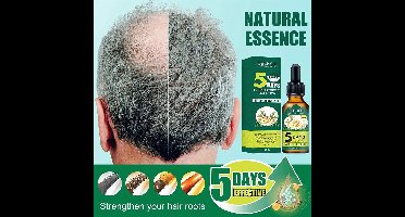 EELHOE 5 Days Gember Haarverzorgingsolie | Haarserum 5 Days | 5 daagse haarkuur | Bestrijding haaruitval | extracten van Gember voor stimuleren haargroei | Haar olie | Bewezen formule | Haargroeiserum - Gember Haar Groeimiddel – Haarherstel |NO: #1