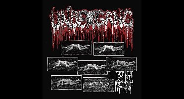 Undergang - De Syv Stadier Af Fordaerv (CD)