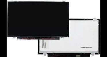 14.0 Inch LCD Scherm 1366x768 Mat 30Pin eDP