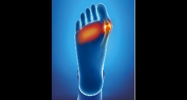 Epitact Kussentjes Met Dubbele Bescherming Maat 36-38