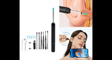 Earwizard Oorreiniger Met Camera - Haarscherpe Inspecties Binnen Handbereik ...